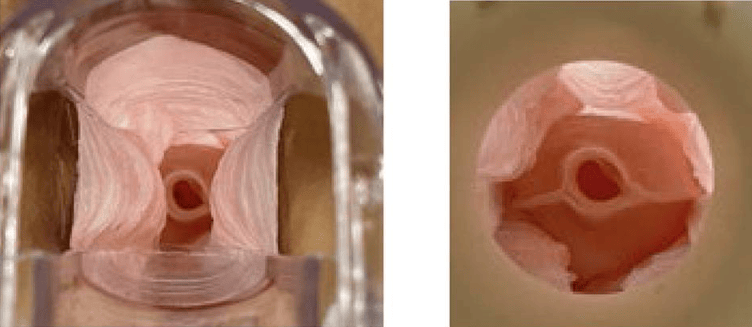 讓無數女性害怕的“鴨嘴鉗”，到底有沒有替代工具？