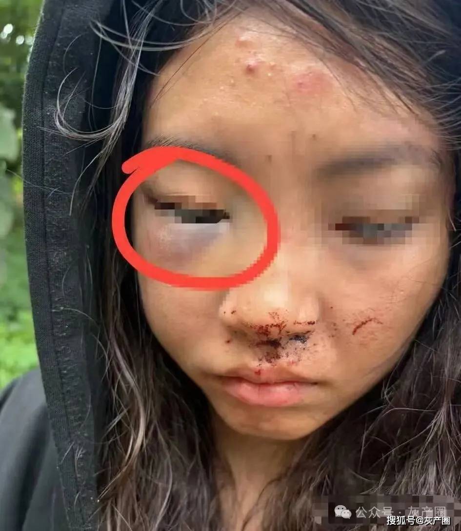 緬甸皎克特大跨境綁架人口販賣犯罪團伙：受害人達四五百人！女性遭遇侵害，男性遭遇暴力毆打！